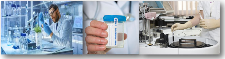 Alcohol Testing Clayton WA